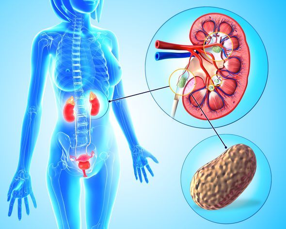 Body Flush – KIDNEY SUPPORT – Bladder Health – Kidney Boost – 2 B 120 Ct