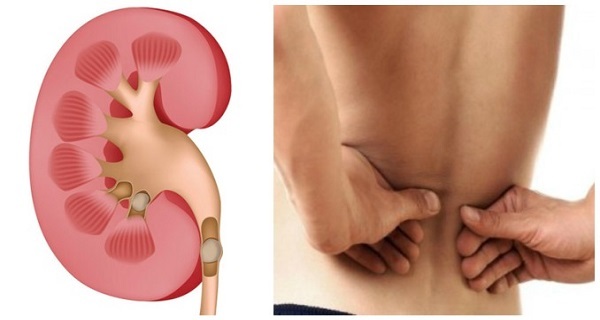 Detoxify Kidneys – KIDNEY SUPPORT – Bladder Health – Kidney Boost – 1 B 60 Ct